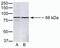 Poly(ADP-Ribose) Polymerase Family Member 9 antibody, 40-4400, Invitrogen Antibodies, Western Blot image 