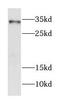 Forkhead Box E3 antibody, FNab03194, FineTest, Western Blot image 