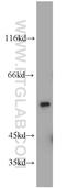 DEP domain-containing mTOR-interacting protein antibody, 21312-1-AP, Proteintech Group, Western Blot image 