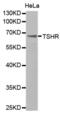 Thyroid Stimulating Hormone Receptor antibody, abx000958, Abbexa, Western Blot image 