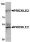 Prickle-like protein 2 antibody, TA320126, Origene, Western Blot image 