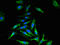 Cyclin-dependent kinase 4 inhibitor C antibody, orb47982, Biorbyt, Immunocytochemistry image 