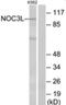 NOC3 Like DNA Replication Regulator antibody, AP33273PU-N, Origene, Western Blot image 