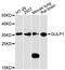 GULP PTB Domain Containing Engulfment Adaptor 1 antibody, A3432, ABclonal Technology, Western Blot image 