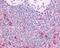 c-Kit antibody, 48-391, ProSci, Immunohistochemistry paraffin image 
