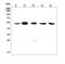 SUFU Negative Regulator Of Hedgehog Signaling antibody, A02279-1, Boster Biological Technology, Western Blot image 