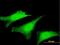 Supervillin antibody, H00006840-M03, Novus Biologicals, Immunofluorescence image 
