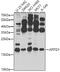MHF1 antibody, GTX32452, GeneTex, Western Blot image 