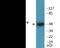 Inhibitor Of Nuclear Factor Kappa B Kinase Regulatory Subunit Gamma antibody, EKC2318, Boster Biological Technology, Western Blot image 