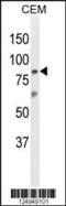 Zinc Finger Protein 160 antibody, 64-182, ProSci, Western Blot image 