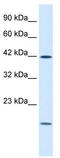 Upstream Transcription Factor 1 antibody, TA335666, Origene, Western Blot image 