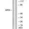 Arylsulfatase Family Member I antibody, PA5-49984, Invitrogen Antibodies, Western Blot image 