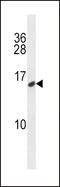 Calcitonin antibody, 58-106, ProSci, Western Blot image 