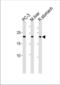 Proteasome subunit beta type-2 antibody, TA328153, Origene, Western Blot image 