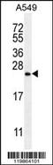 Sorting Nexin 24 antibody, MBS9203589, MyBioSource, Western Blot image 