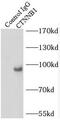 Catenin Beta 1 antibody, FNab09871, FineTest, Immunoprecipitation image 