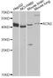 Reticulocalbin 2 antibody, A12496, ABclonal Technology, Western Blot image 