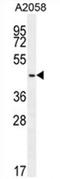 DDB1 And CUL4 Associated Factor 4 Like 2 antibody, AP54536PU-N, Origene, Western Blot image 