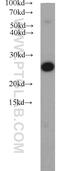 Adenylate kinase 2, mitochondrial antibody, 11014-1-AP, Proteintech Group, Western Blot image 