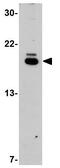 Serine/Threonine Kinase 39 antibody, GTX31784, GeneTex, Western Blot image 