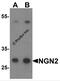 Neurogenin 2 antibody, 7091, ProSci Inc, Western Blot image 