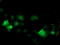 Cyclin Dependent Kinase 2 antibody, TA502943, Origene, Immunofluorescence image 