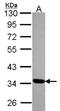 Translocase Of Outer Mitochondrial Membrane 34 antibody, NBP2-20682, Novus Biologicals, Western Blot image 