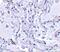 p240 antibody, A02017, Boster Biological Technology, Immunohistochemistry paraffin image 