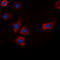 EGFR antibody, LS-C356019, Lifespan Biosciences, Immunofluorescence image 