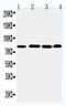 Prospero homeobox protein 1 antibody, LS-C313329, Lifespan Biosciences, Western Blot image 
