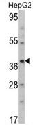 Aminomethyltransferase antibody, AP17103PU-N, Origene, Western Blot image 