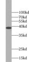 Survival Of Motor Neuron 2, Centromeric antibody, FNab08031, FineTest, Western Blot image 