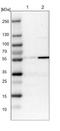 Major Facilitator Superfamily Domain Containing 11 antibody, NBP1-93984, Novus Biologicals, Western Blot image 