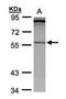 Propionyl-CoA Carboxylase Subunit Beta antibody, TA308402, Origene, Western Blot image 