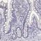 Lymphocyte antigen 6D antibody, HPA064317, Atlas Antibodies, Immunohistochemistry paraffin image 