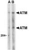 Serine-protein kinase ATM antibody, TA306355, Origene, Western Blot image 