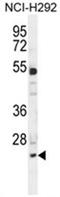 BAF Chromatin Remodeling Complex Subunit BCL7A antibody, AP50360PU-N, Origene, Western Blot image 