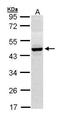 4-Hydroxyphenylpyruvate Dioxygenase antibody, GTX103994, GeneTex, Western Blot image 