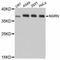 Neugrin, Neurite Outgrowth Associated antibody, LS-C747314, Lifespan Biosciences, Western Blot image 
