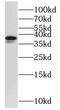 Mitochondrial Ribosomal Protein S31 antibody, FNab05360, FineTest, Western Blot image 