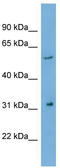 RRAD And GEM Like GTPase 1 antibody, TA334490, Origene, Western Blot image 