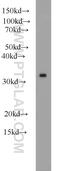 Proteasome subunit alpha type-1 antibody, 11175-1-AP, Proteintech Group, Western Blot image 
