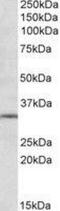 Metabotropic glutamate receptor 2 antibody, NBP1-68855, Novus Biologicals, Western Blot image 