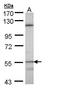 Cytochrome P450 Family 4 Subfamily B Member 1 antibody, GTX109008, GeneTex, Western Blot image 