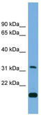 CTD Small Phosphatase 2 antibody, TA340072, Origene, Western Blot image 