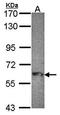 Myotubularin-related protein 9 antibody, orb69879, Biorbyt, Western Blot image 