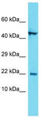 Cilia And Flagella Associated Protein 126 antibody, TA334833, Origene, Western Blot image 