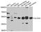 Solute Carrier Family 2 Member 4 antibody, STJ29952, St John