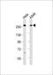 SEP antibody, M02711, Boster Biological Technology, Western Blot image 