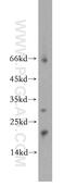 Nudix Hydrolase 3 antibody, 20542-1-AP, Proteintech Group, Western Blot image 